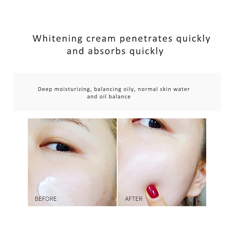 In stock dark spot removing Arbutin beauty whitening cream face and body