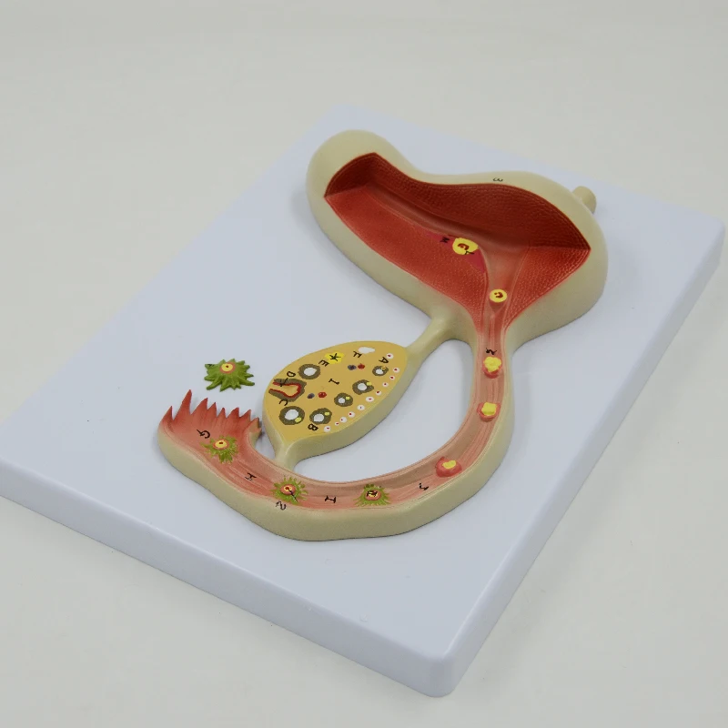 Ovary анатомическая модель женская репродуктивная система анатомия матки обучающее оборудование медицинский подарок Обучающие ресурсы