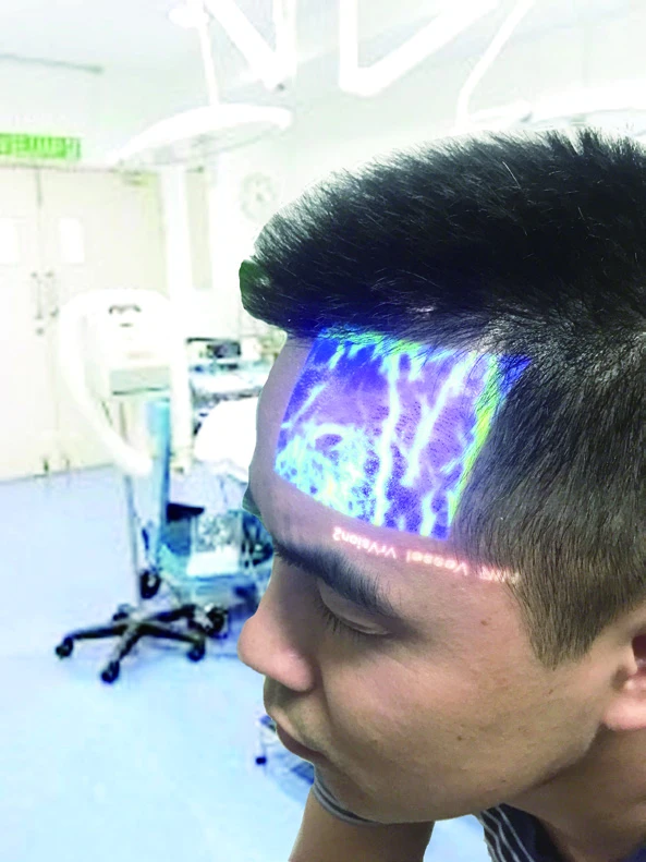 
Wholesale Price Medical Portable Handheld Projection Vein Finder 