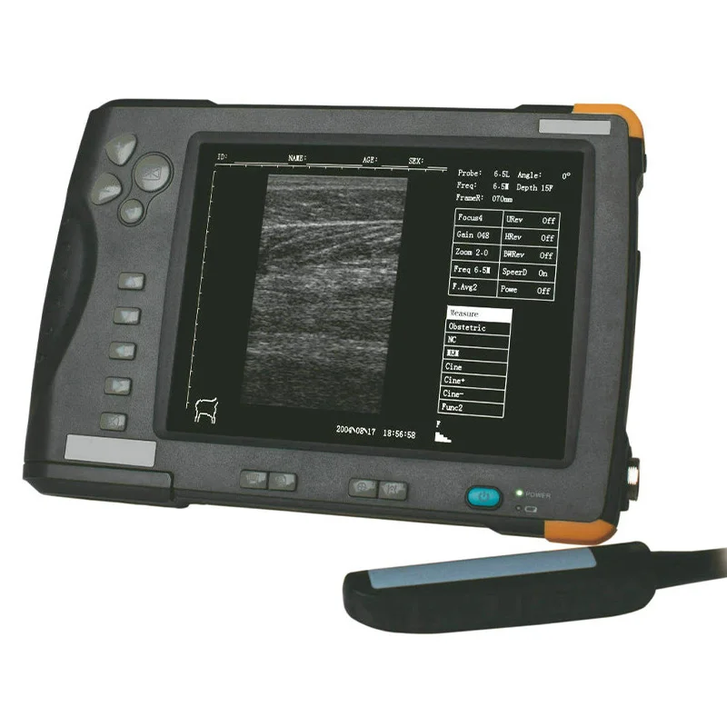 China Manufacturer Exceptional Factory Direct Price Custom Portable Ultrasound Machine Veterinary Ultrasound