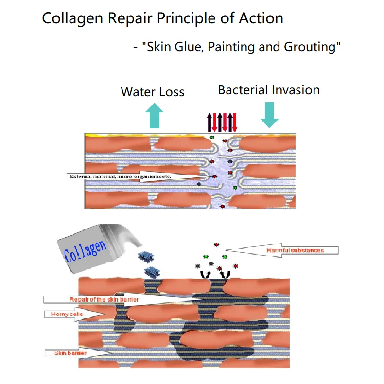 Repair wound care type III humanized collagen damage skin repair dressing Collagen Functional Repair Cream