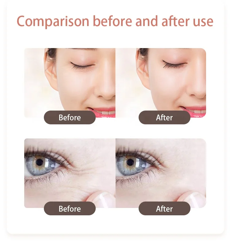 Hot and cold eye massage mini beauty salon equipment for eyes, lip, face