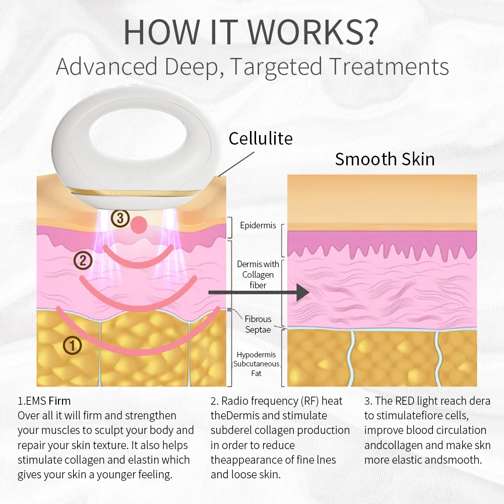 ODM/OEM rf body slimming device body shaping cellulite slimming fat burning stretch mark removal smooth shapes cellulite machine