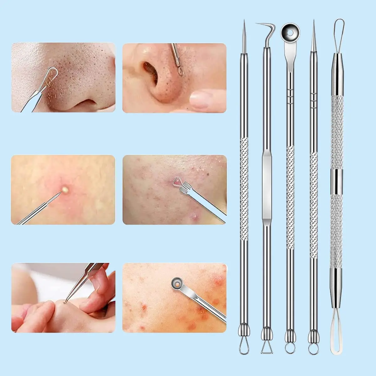 8pcs/set Blackhead Remover Pimple Popper Tool Kit,Black Head Acne Removal Extractor