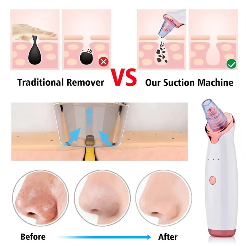 Household Blackhead Absorber Pore Cleaning Beauty Wash ABS Electric Blackhead Absorber Acne Removal Export Facial Cleansing