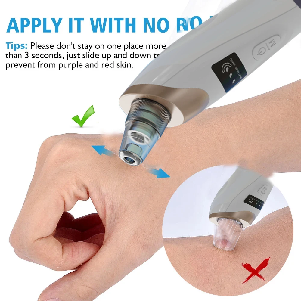 5 In 1 Portable Electric Blackhead Suction Device Blackhead Remover With 5 Probes Household Face Pore Cleaner With LED Display
