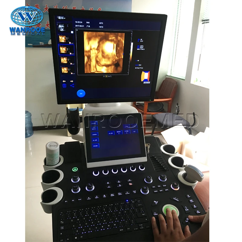 USC900 Trolley 4D Color Doppler 360 Ultrasound Probe Scanner Machine with Dual Display