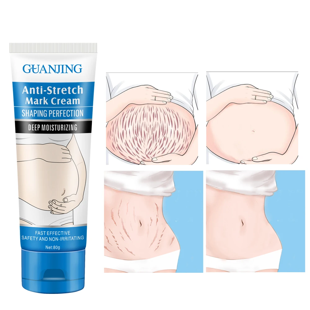 
Wholesale high quality skin care powerful anti stretch mark pregnancy cream 