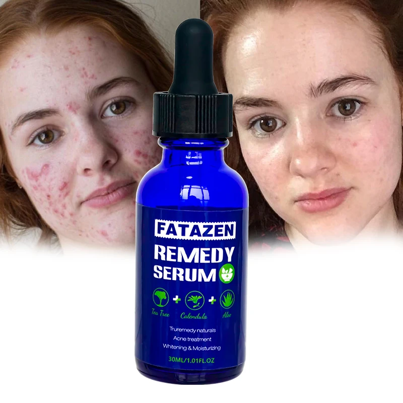 Private Label Natural Organic Anti-Inflammatory Anti-Aging Remedy Serum Skin Care Facial Serum Hydration Brightening Face Serum