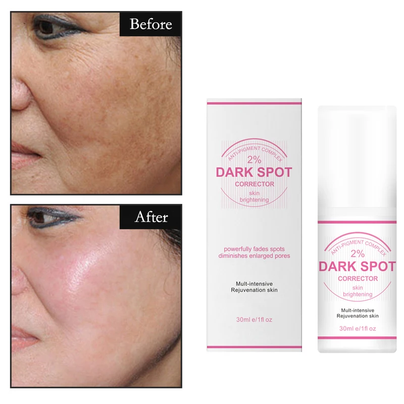 private label Best Korean Whitening Crean Niacinamide Fast Lightening Body Underarm Permanent Skin Whitening Dark Spot Corrector