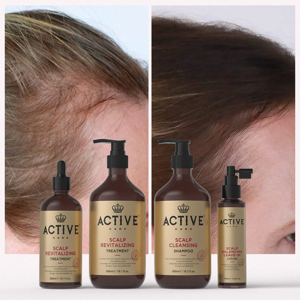 oem Red Onion Shampoo Hair hair loss growth conditioner Manufacturer hair care products rosemari shampoo