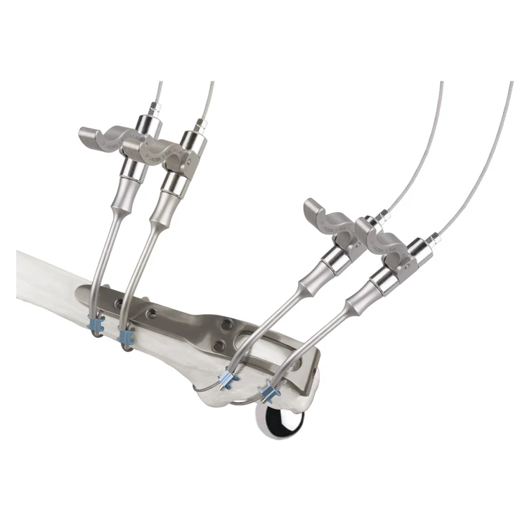Orthopedic Trauma Implants - Titanium Binding System