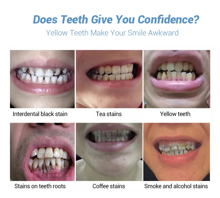 OEM Teeth Whitening Essence Liquid Profession Oral Hygiene Teeth Bleaching Essence Private Label