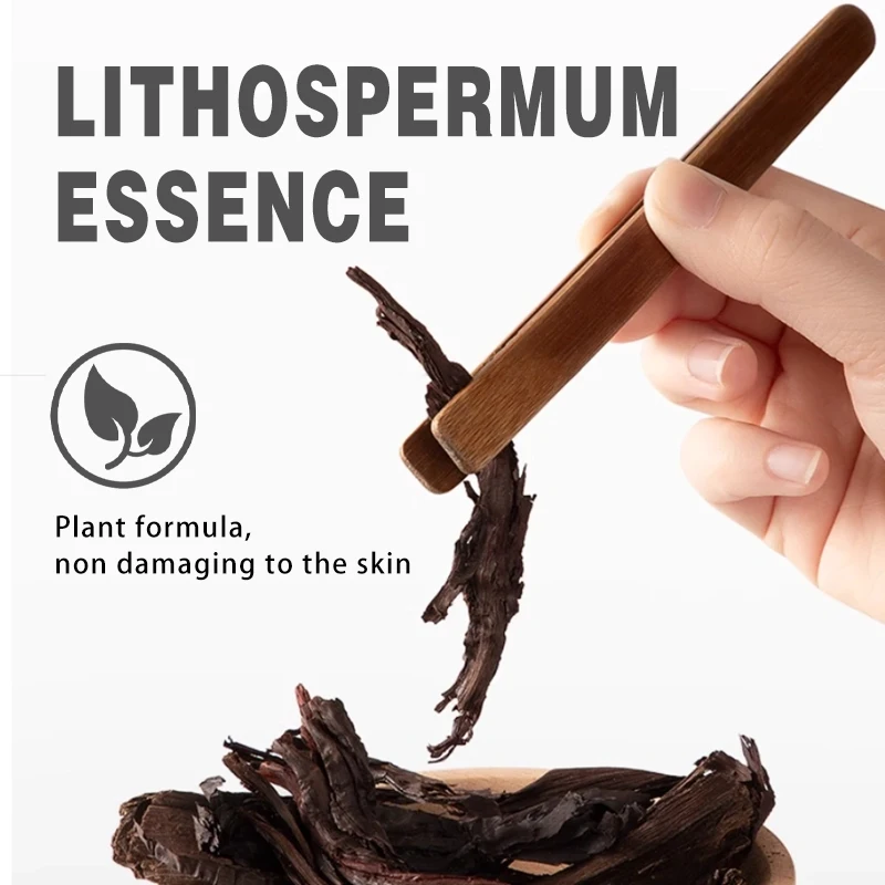 Wholesale OEM/ODM Natural Moisturizing Eczema Cream Relieve Redness Baby Diaper Rash Cream