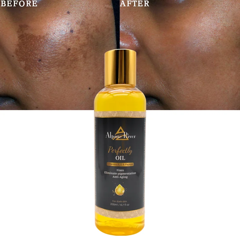 Private Label Organic Vitamin E Turmeric Remove Dark Spot Pigmentation Correction Papaya Body Oil For Dark Skin Lightening