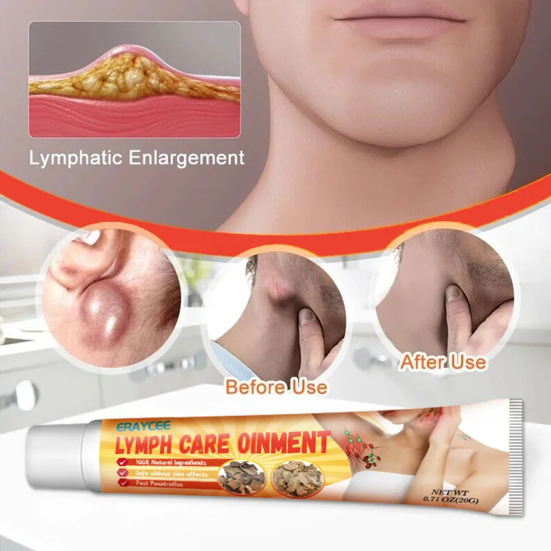 Herbal Lymphatic Drainage Cream Anti-Swelling Lymph Node Treatment Breast Ointment Lymphatic Ointment