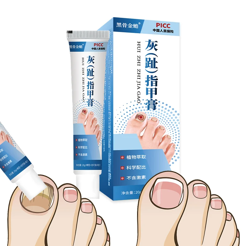 Grey nails cream Suitable for deck turbidness to remove nail thickening people best selling products 2024