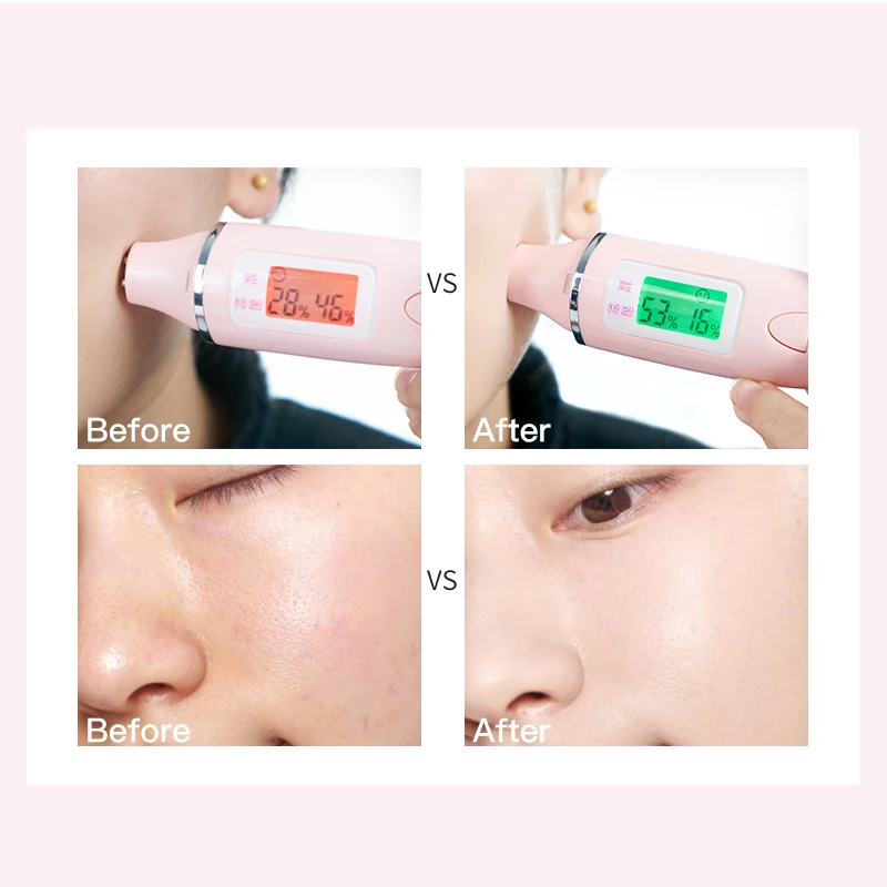 Plant extract moisturizing facial mask oil control sleep mask blackhead remover hyaluronic acid acne treatment skin care mask