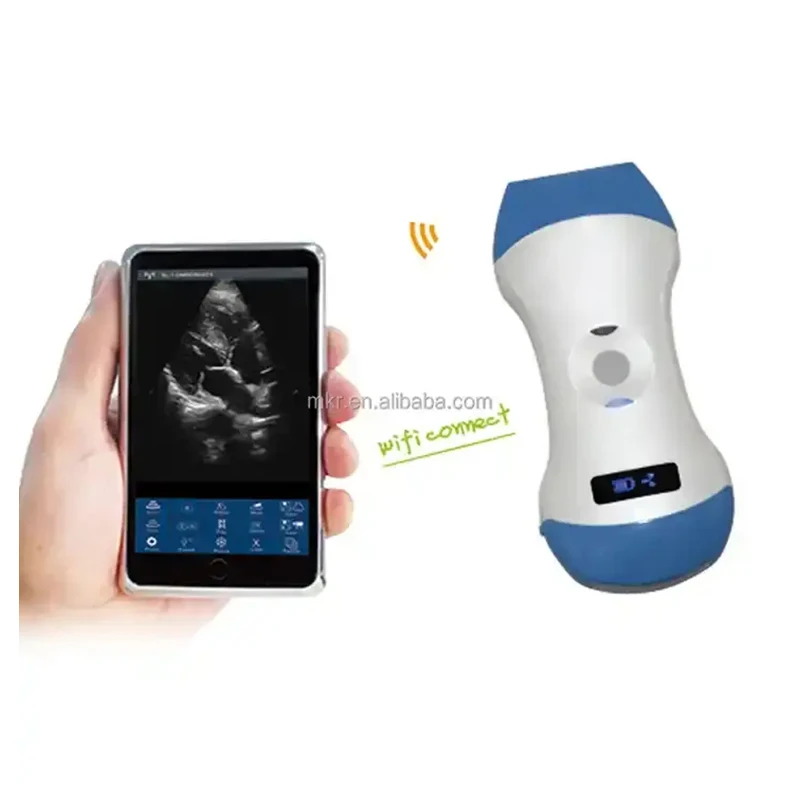 Hospital Diagnostic Equipment Wireless Ultrasound Probe Scanner Full Digital Ophthalmic Ultrasound Scanner