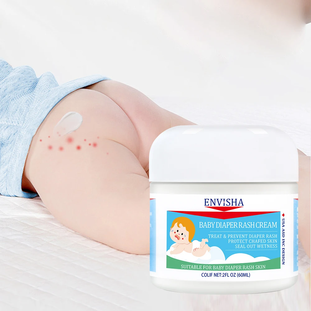 Strong Effective Baby Butt Barrier Ointment Rash Prevention Cream Infant Daily Relieve Prevent Diaper Rash Cream with Zinc Oxide