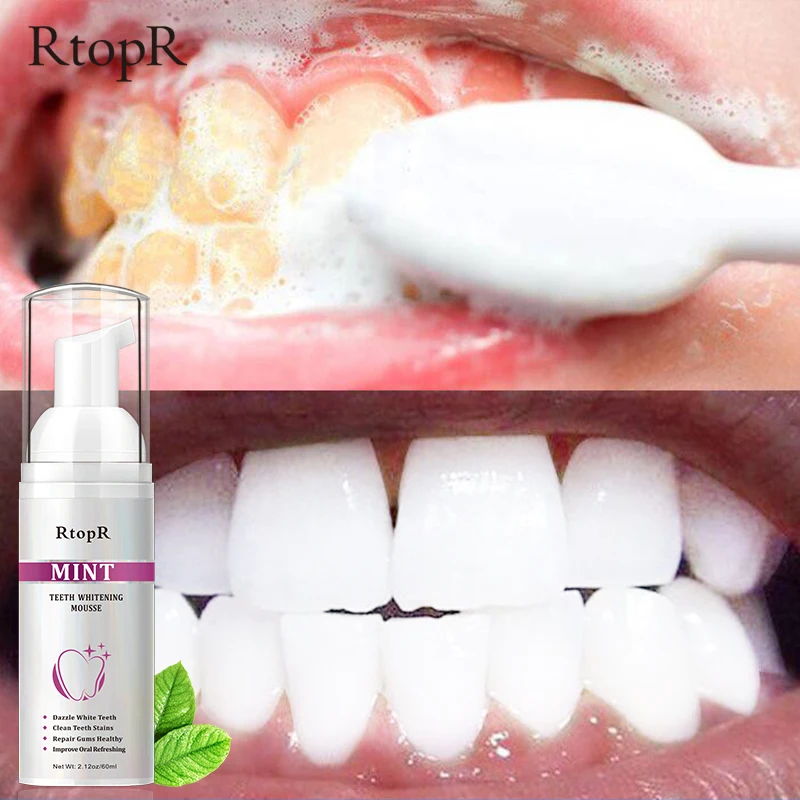 Oral Hygiene Care Teeth Whitening Mousse Remove Plaque Dental Organic Tooth Whitening
