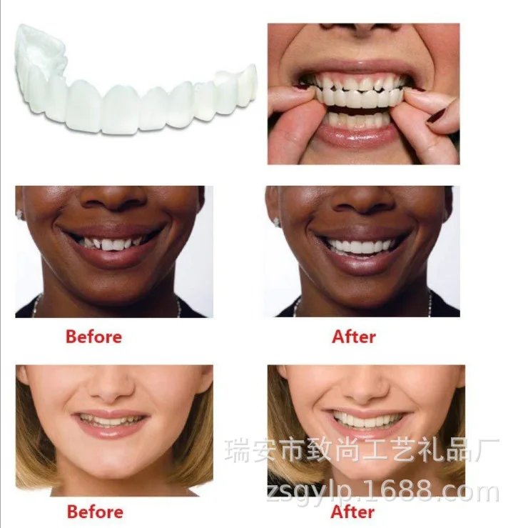 customized  label Upper and lower False teeth cover Perfect Smile Veneers Comfort Fit Flex Denture Paste fake braces