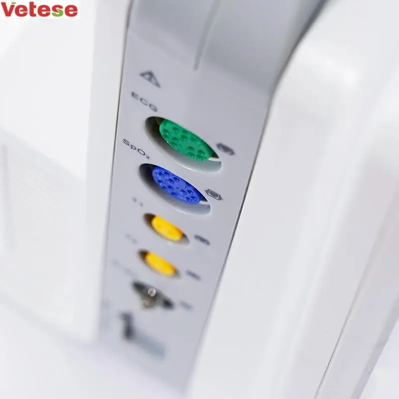 Yonker 12inch 6   multiparameter patient monitor cardiac monitor vet monitor  touch screen bulit-in printer