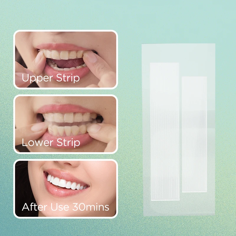 Custom Fruit Flavor Beautiful Smile Mint Teeth Whitening Strips Bleaching Pap No Alcohol Wholesale