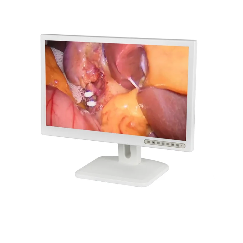 Whosale hd medical endoscope camera with cold light source for ent