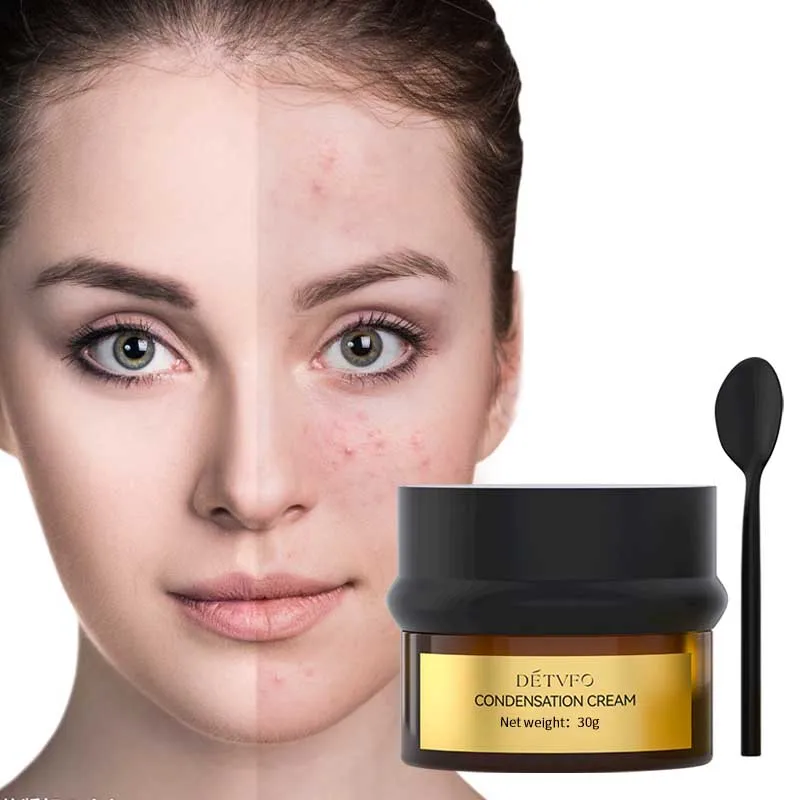 Without Side Effects Facial Whitening Antiaging Moisturizer Face Cream For Men And Women