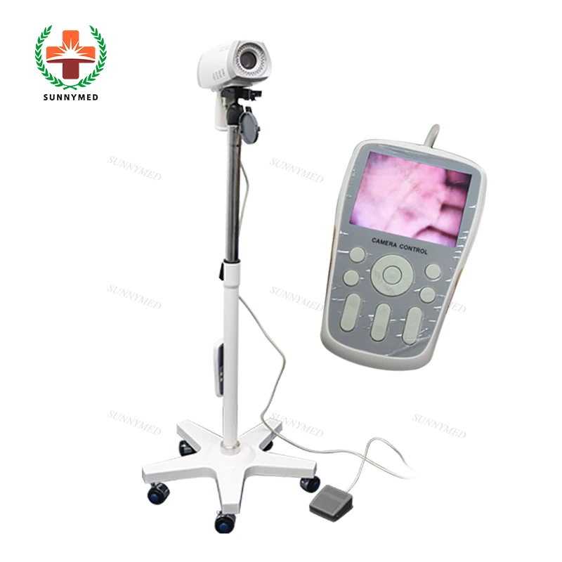 Sunnymed SY-F005 портативный цифровой видео влагалища кольпоскоп