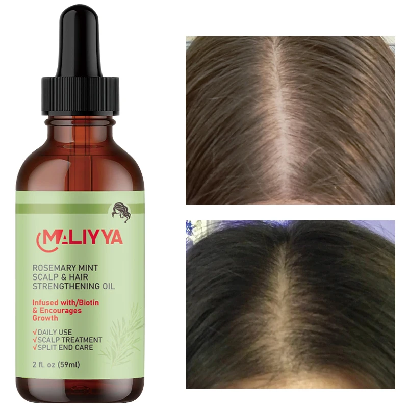 Wholesale private label rosemary hair essence 59ML natural organic nourishment promote hair growth OEM hair essence