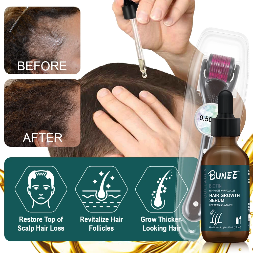 Free Sample Fast Effective Hair Growth Oil help hair regrowth set for black women