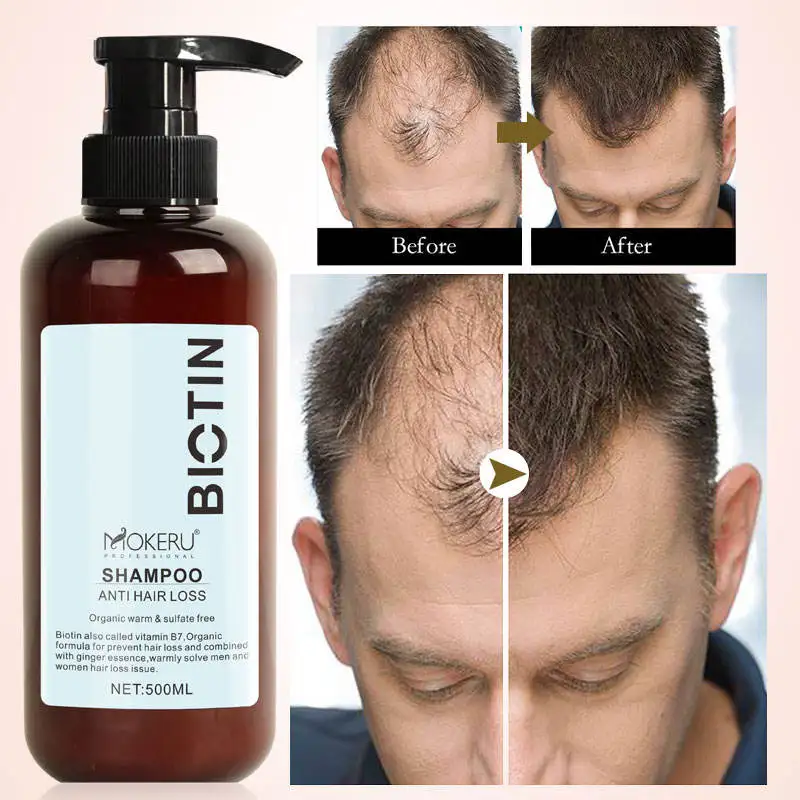Wholesale MOKERU Biotin Collagen Korean Shampoo Prevents Hair Loss 100% Sulfate Free Custom Shampoo