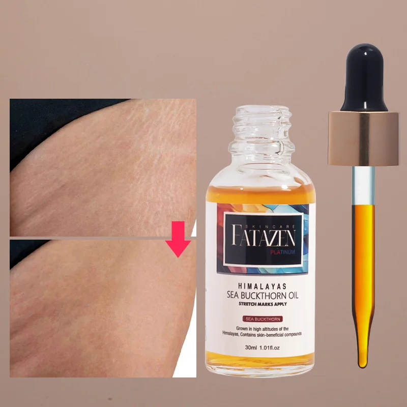 Private Label Skincare Aloe Vera Massage Essential Oil For Improve Skin Elasticity OEM Pure Sea Buckthorn Oil For Stretch Mark