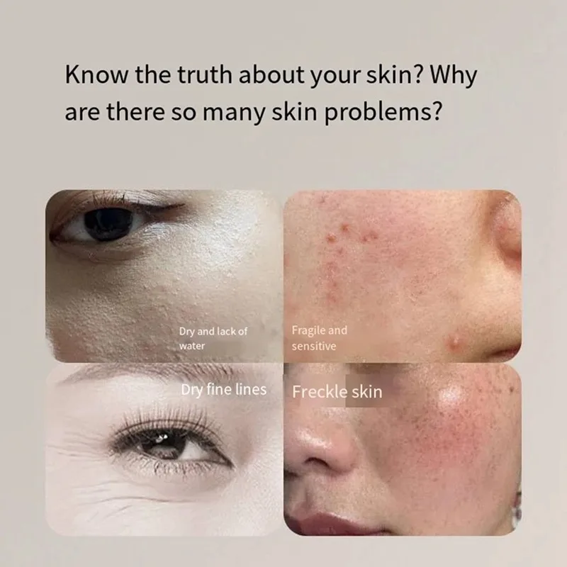 New Skin Detector Portable Easy Operate Facial Tester Detector Skin Oil Content Analyzer for Beauty Salon Spa Home