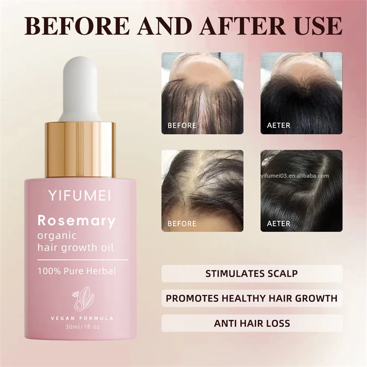 Natural Rosemary Argan Oil Anti Hair Loss Treatment Hair Scalp Care Growth Regrowth Elixir Oil For Black Men Women