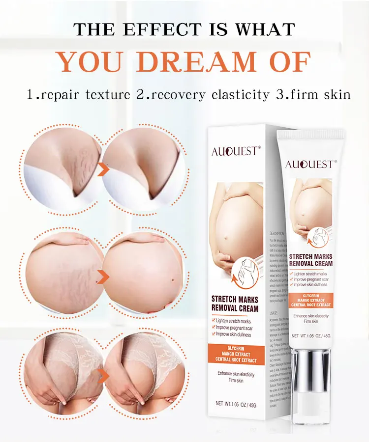 
New arrival stretch marks removal cream and tighten skin repair OEM 