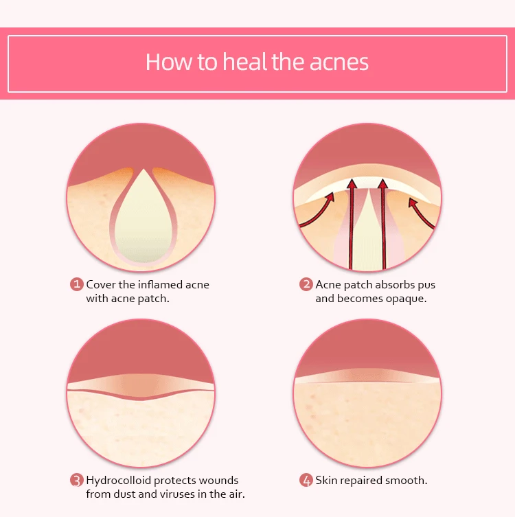Oil Absorbing transdermal heart patch,acne pimple master,hydrocolloid acne patch skin care trouble care