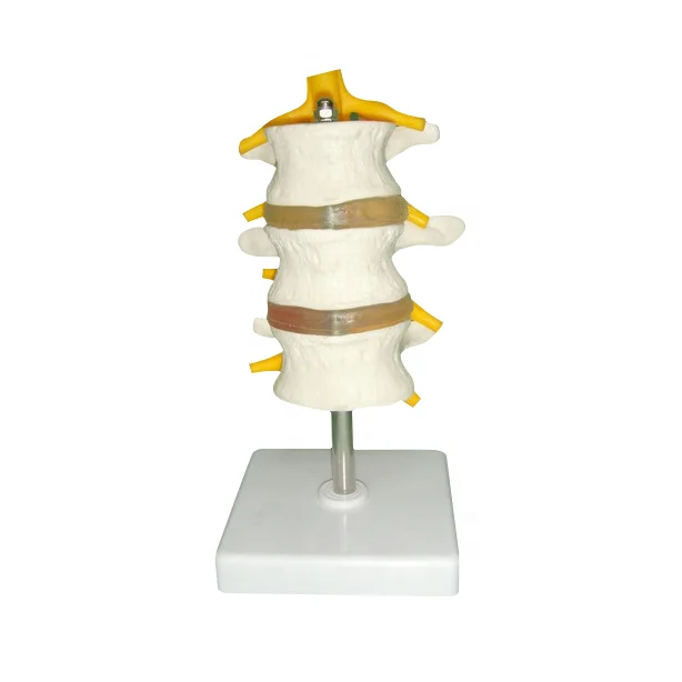 Medical Science Three segments lumbar disc band nerve root teaching model