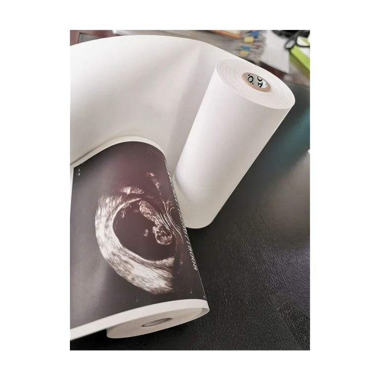 Customized Medical ultrasound high glossy thermal paper 110HG Thermal Paper