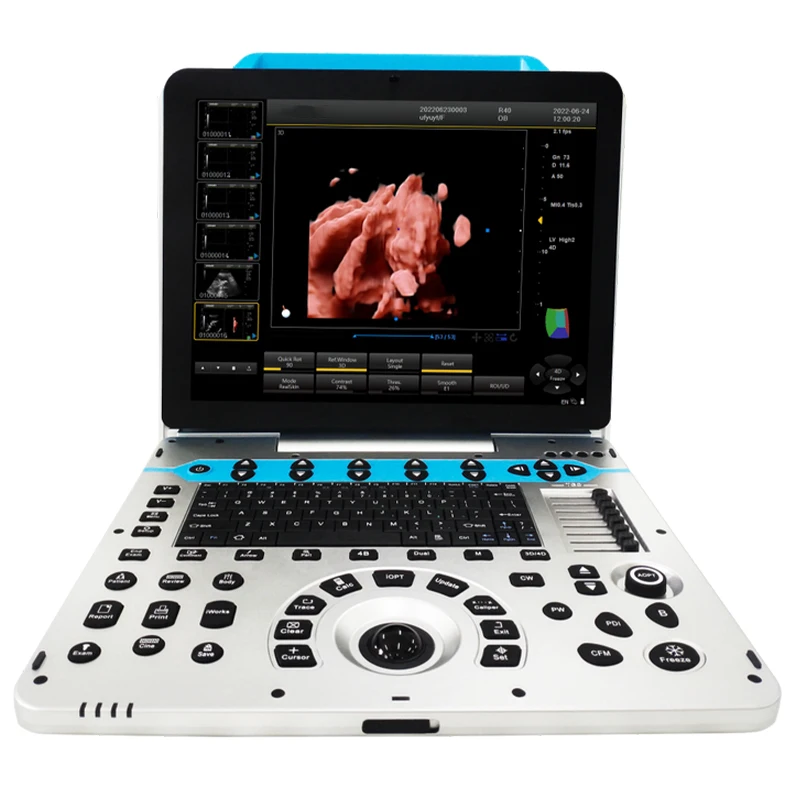 Portable ultrasound scanner 3D color doppler type medical digital ultrasound scanner