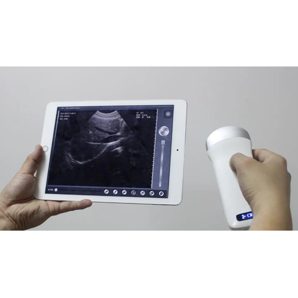 Suresult 80 Elements 3.5 MHz Convex Ultrasound 5GWifi Wireless Ultrasound Probe medical ultrasound instruments