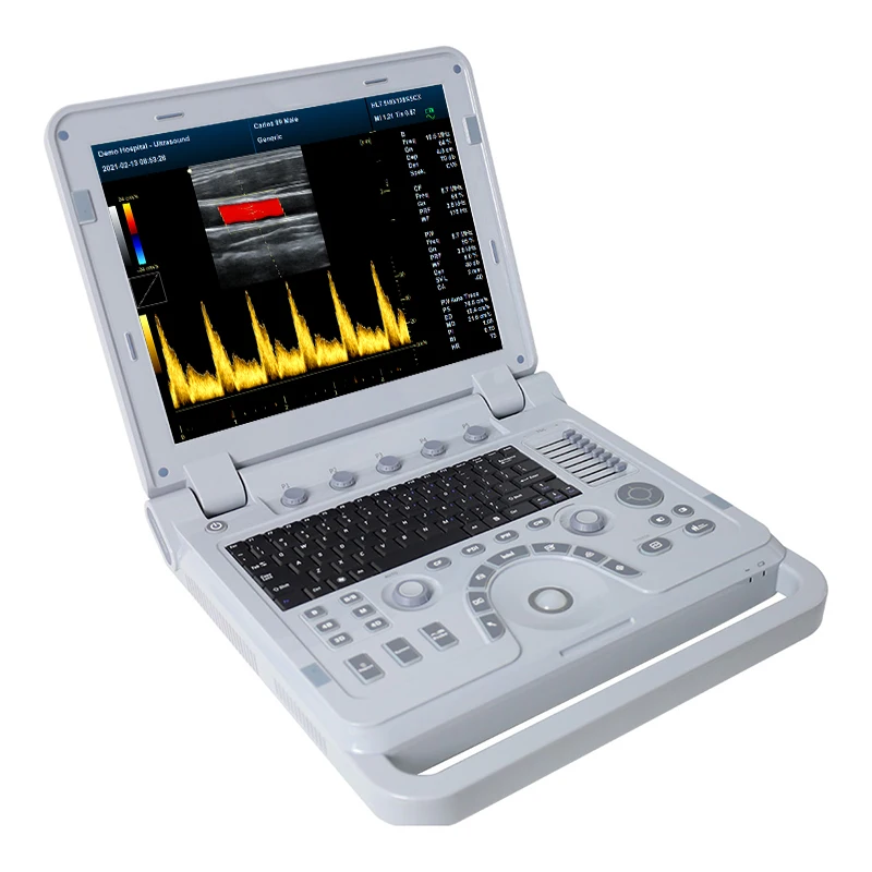 CONTEC CMS1700A Color Doppler USG Color Ultrasound Scanner Diagnostic Machine Systems Convex Probe