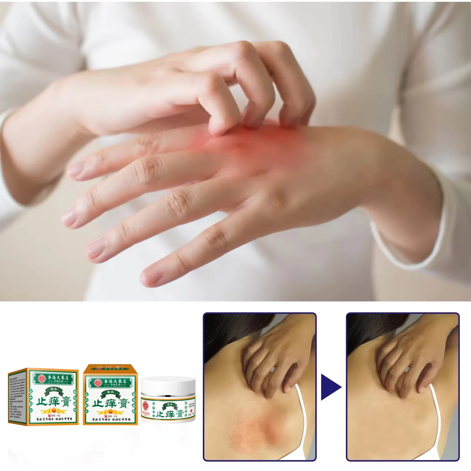Private Label Health Care Supplement Icy Itch Cream Herbasia Remedy For Skin irritation Available