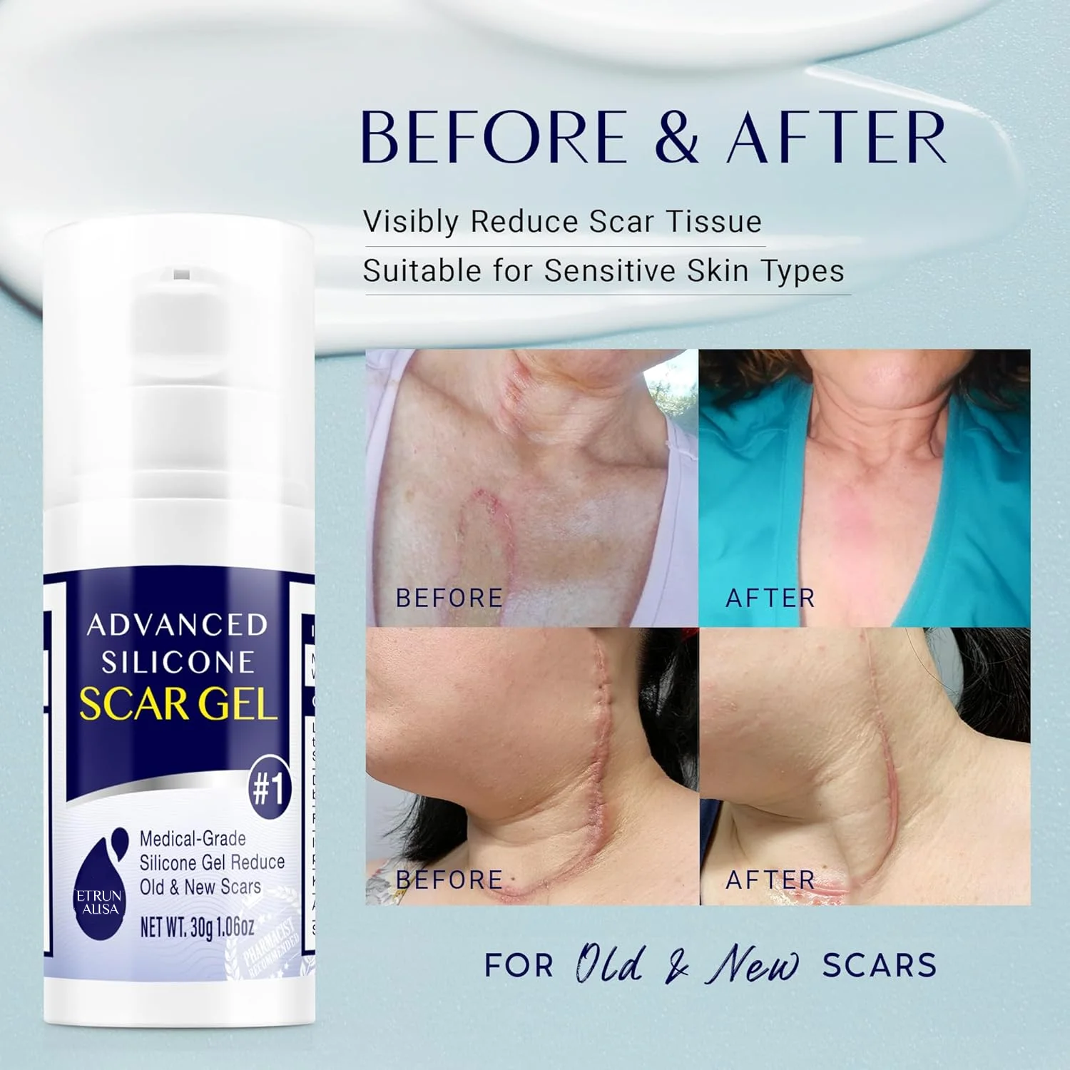Private Label Silicone Scars Gel Medical Grade Treatment Acne Injury Burns Stretch Mark Reduction Silicone Cream