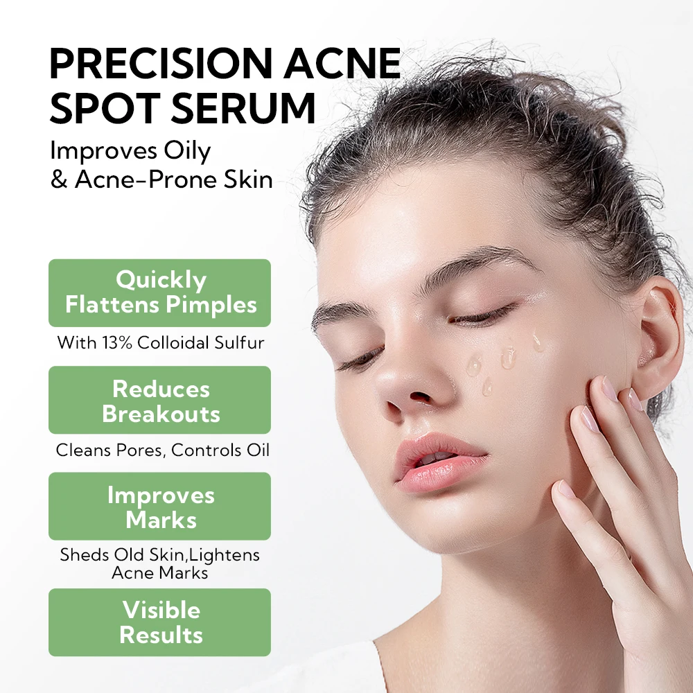 LANBENA Skin care anti acne serum with 5% Niacinamide + 2% Salicylic Acid Serum for Skin Repairing clears improves Marks