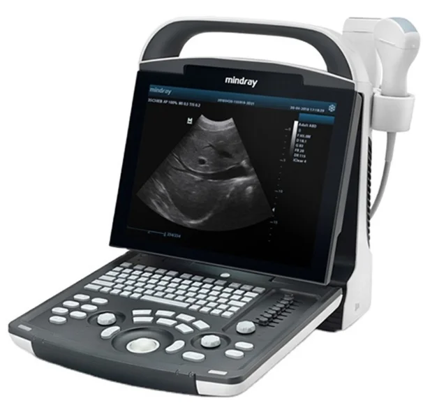 DP-10 Popular Best B/W Ultrasound Scanner Ultrasound medical ultrasound instruments