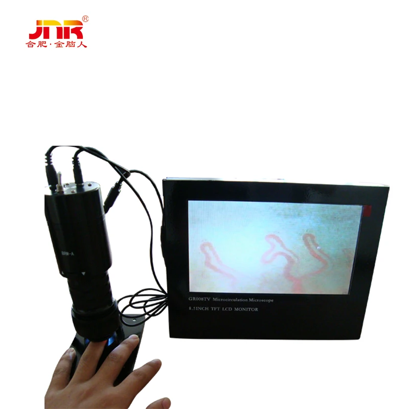 Pathological analysis equipment  microcirculation diagnosis microscope