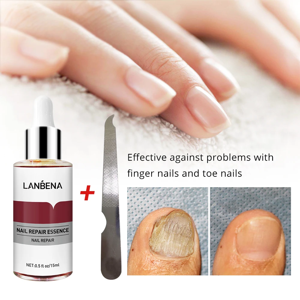 LANBENA Private Label Nail Fungal Treatment Serum Nail Care Repairing Nourishing Essence